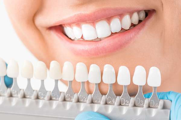 Ask a Cosmetic Dentist: What Are Veneers from St. George Dental Care in St George, UT