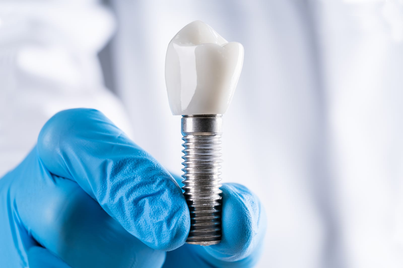 Am I Too Old For Dental Implants? What Seniors In St  George Should Know