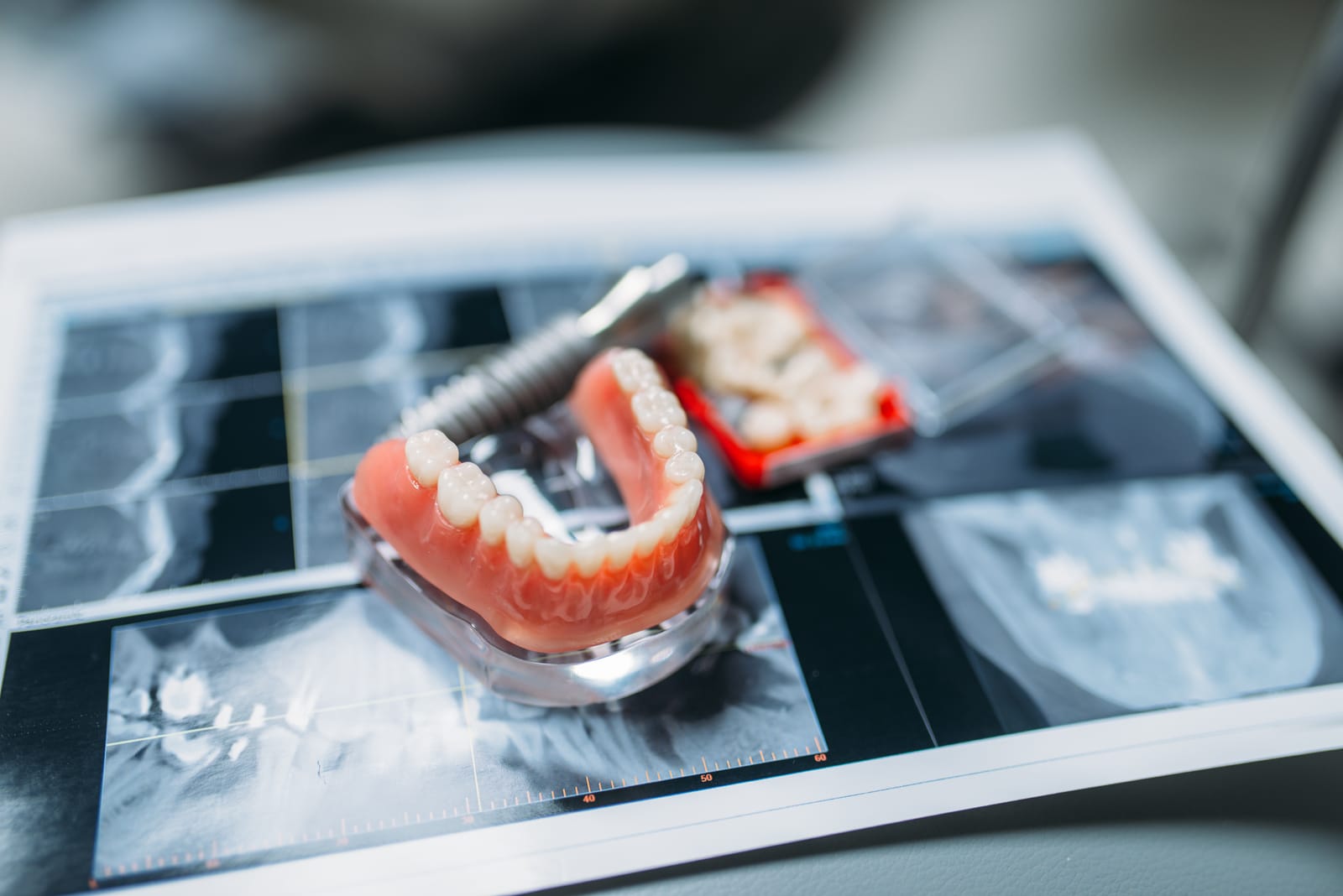 Dentures In A Day: Is It Right For You?