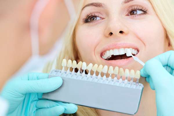 How a Cosmetic Dentist Places Dental Veneers from St. George Dental Care in St George, UT