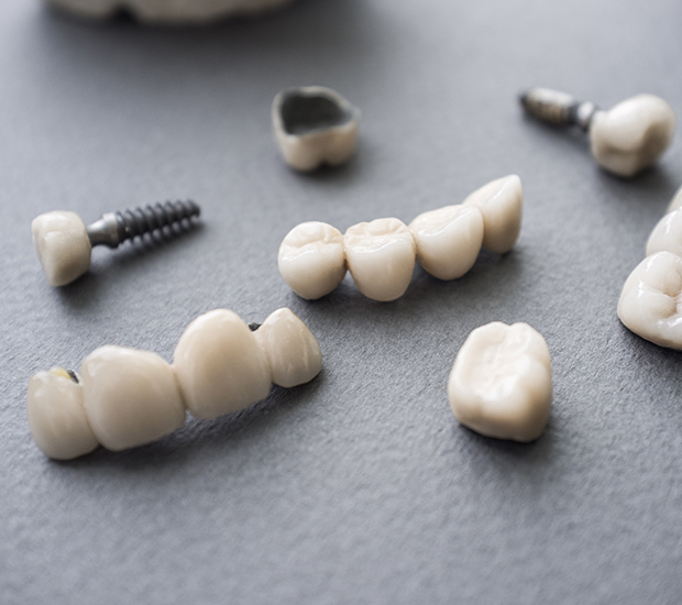 St George The Difference Between Dental Implants and Mini Dental Implants
