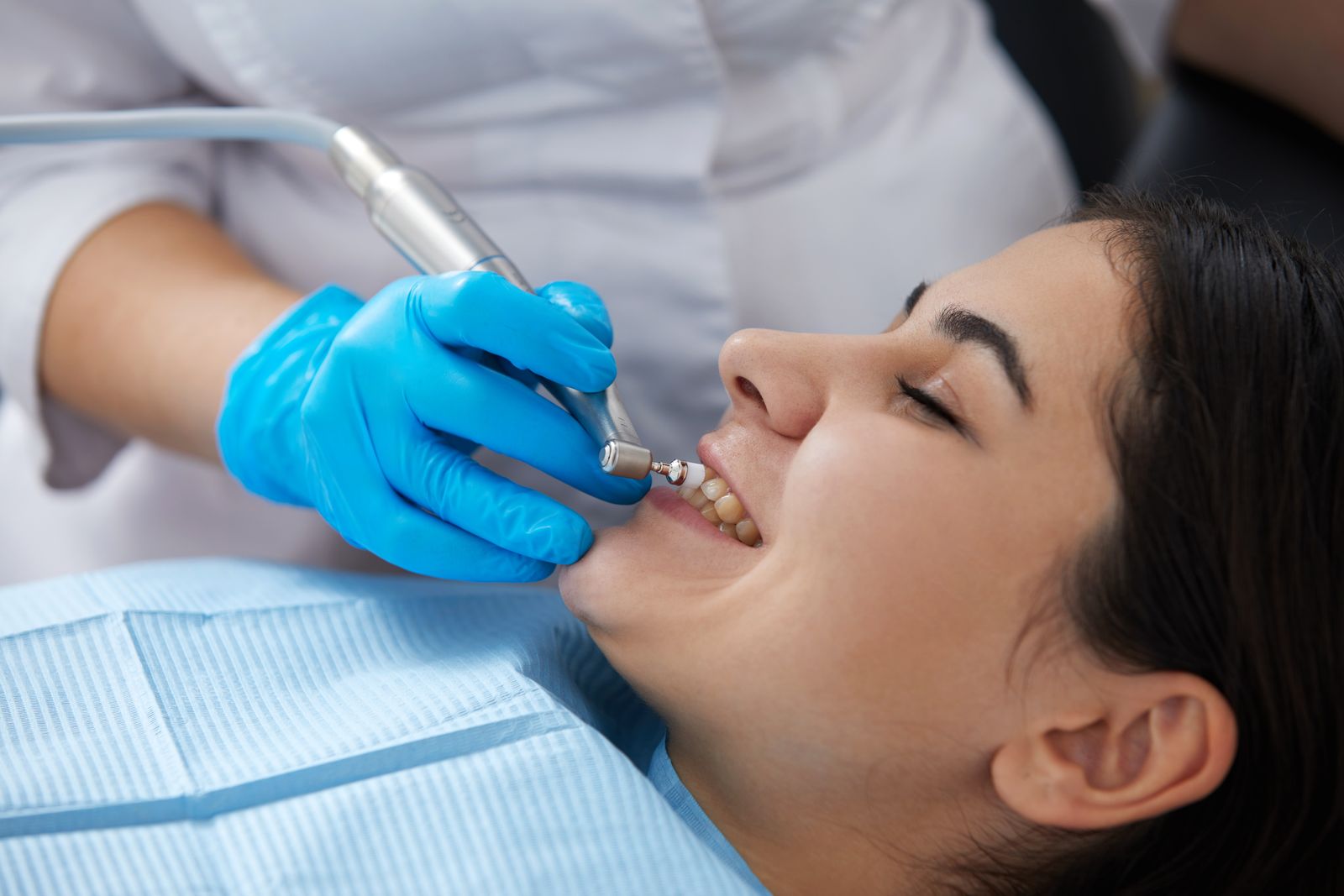 How Periodontitis Tooth Polishing Can Boost Oral Health