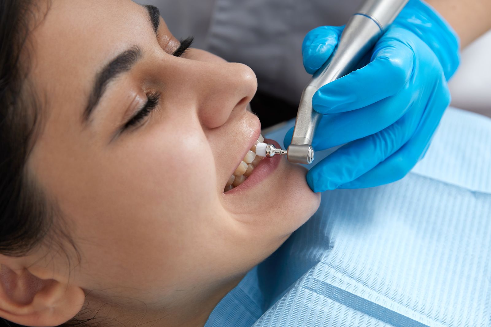 Polished Dental Care: What It Is And Why You Need It