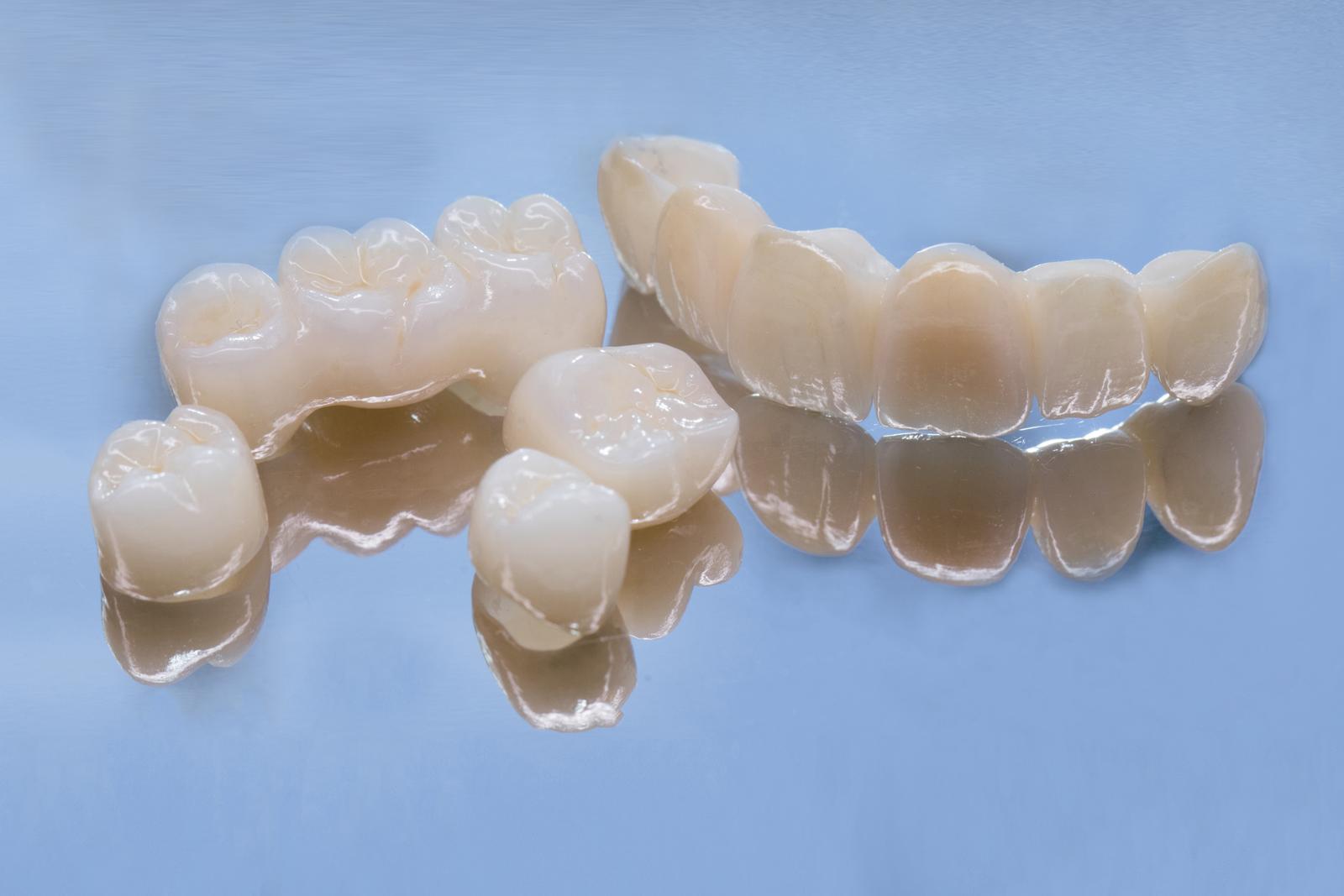 Exploring Types Of Veneers: Which One Is Right For You?