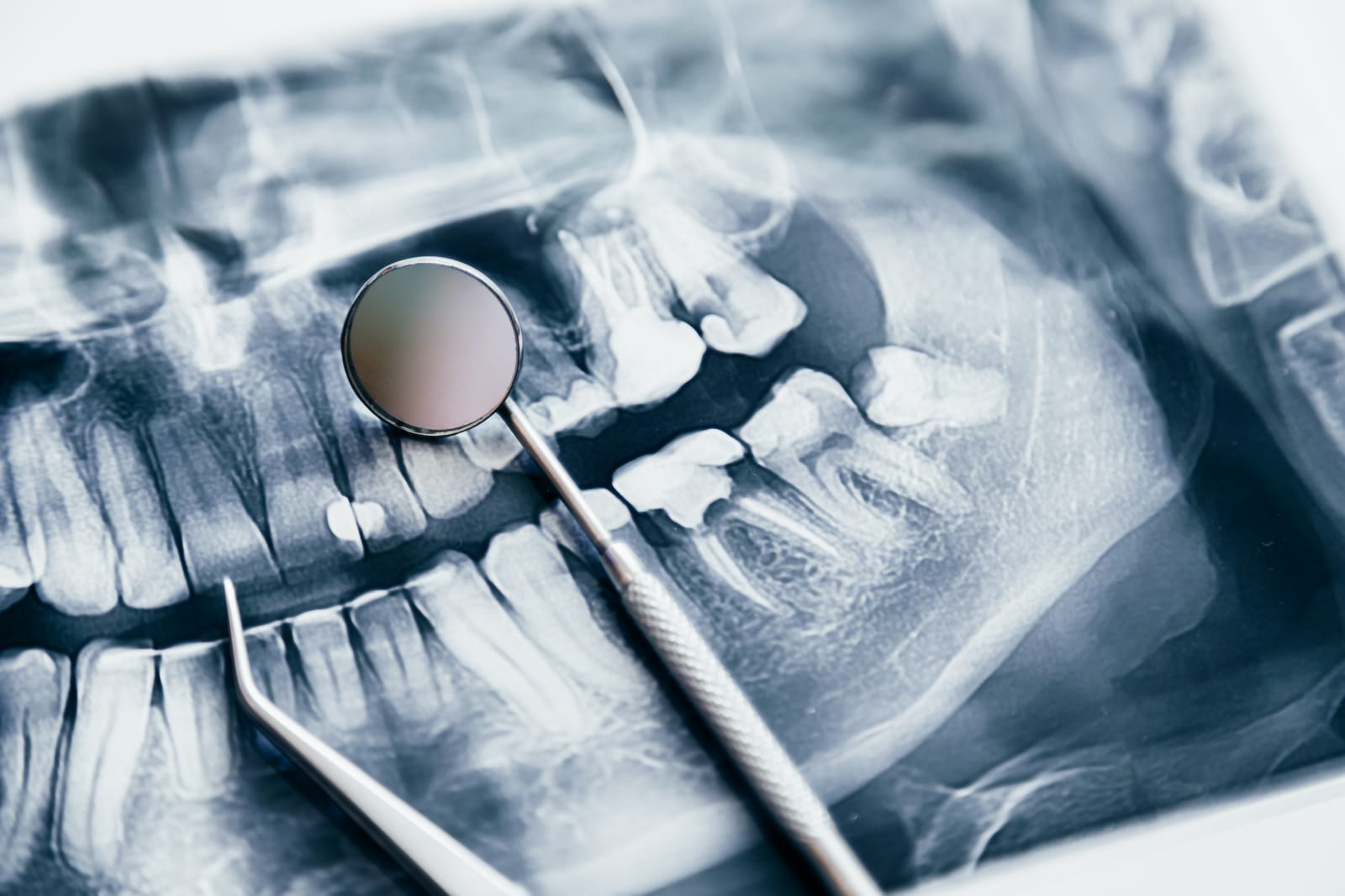 What Is An Oral Surgeon? When You Need One &#   ; What They Treat