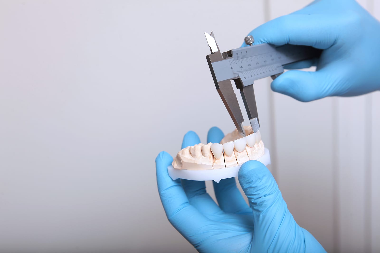 Your Complete Guide: Composite Resin Veneers And Benefits